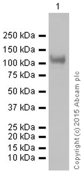 Anti-Sarcomeric Alpha Actinin antibody [EP2529Y](AB68167)