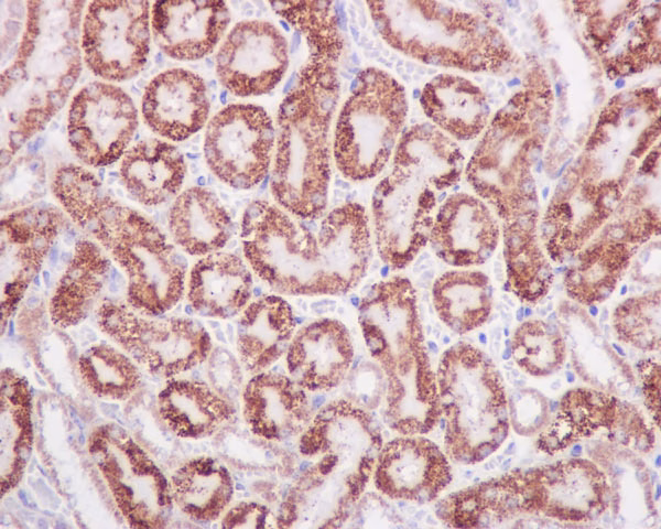 Stat6 Antibody Ye361 Ab32520 Immunohistochemistry Formalin Pfa Fixed Paraffin Embedded Sections Img31775