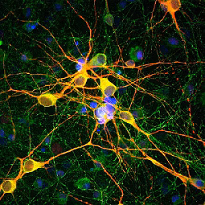 Ab5392 antibody staining of MAP2 (red) and Tau (green) in rat E20 cultured cortical neuron-glial cells, with DAPI nuclear counterstain (blue).