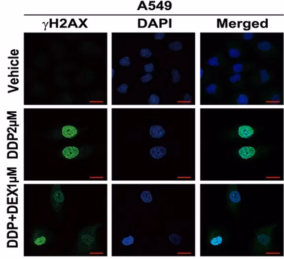 Immunofluorescence staining of A549 lung cancer cells showing DNA damage (green) and nuclei (blue).