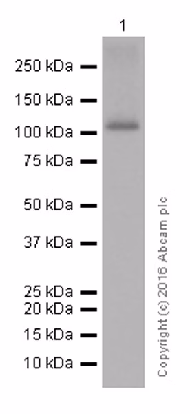 Western blot of Androgen Receptor protein in mouse prostate lysates.