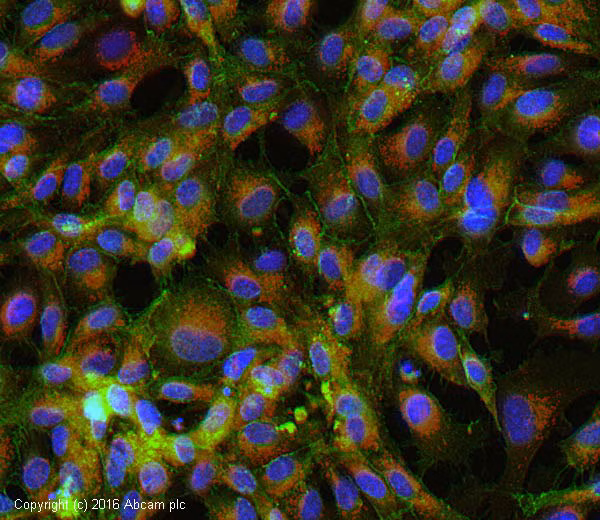 Immunocytochemistry of HUVEC cells stained with anti-CD31 antibody [JC/70A] (ab9498) for vascular research