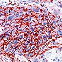 Anti-Glucose Transporter GLUT1 antibody(AB15309)