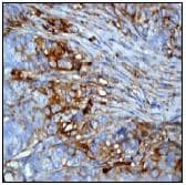 Anti-beta III Tubulin antibody [EP1569Y] - Neuronal Marker(AB52623)