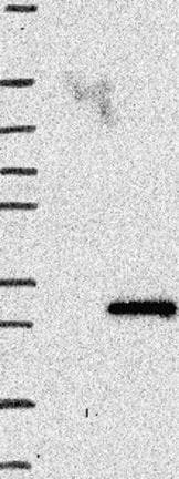 Apc15 Antibody Ab122349  Western Blot Img67783