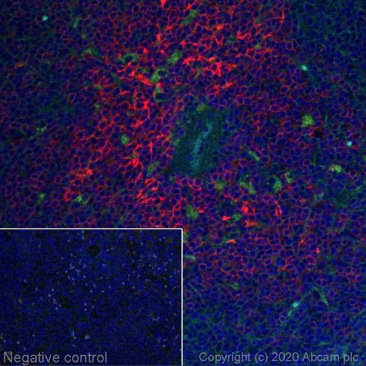 Alexa Fluor 647 Ccr7 Antibody Epr23192 57 Ab275165  Immunohistochemistry Formalin Pfa Fixed Paraffin Embedded Sections Img135229