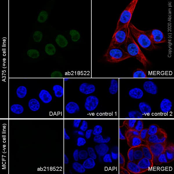 Anti-SOX10 antibody [SOX10/991](AB218522)