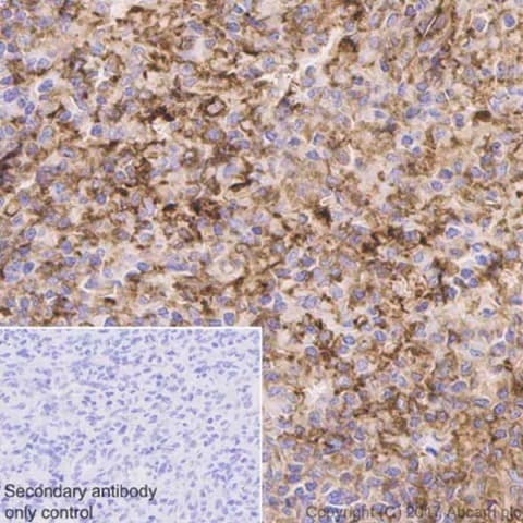 Anti-CD39 antibody [EPR20627](AB223842)