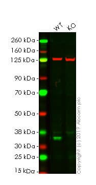 Anti-Cyclin D1 antibody [SP4](AB16663)