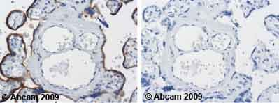 Anti-LAMP2 antibody [H4B4] - Lysosome Marker(AB25631)