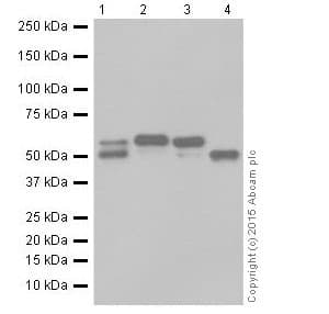 Anti-alpha 1 Antitrypsin antibody [EPR17087-50](AB207303)