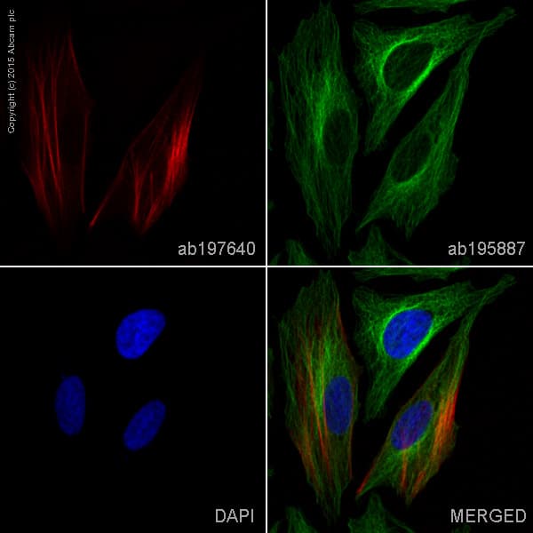 Alexa Fluor® 647 Anti-Calponin 1 antibody [EP798Y](AB197640)