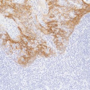 Anti-TROP2 antibody [SP293] - BSA and Azide free(AB272014)