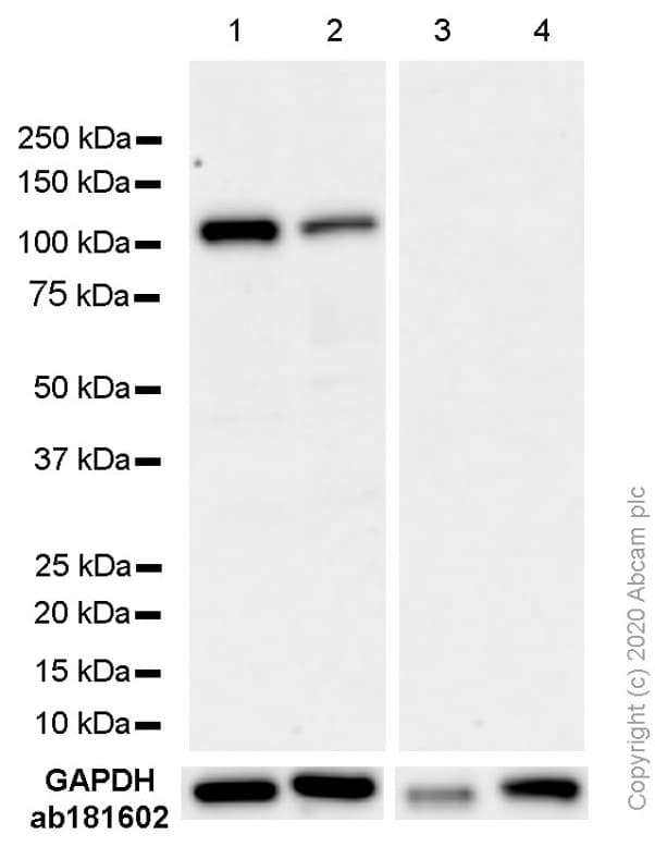 Anti-Androgen Receptor antibody [EP670Y](AB52615)