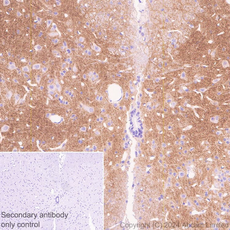 Pmca2 Antibody Epr28923 56 Bsa And Azide Free Ab319151  Immunohistochemistry Formalin Pfa Fixed Paraffin Embedded Sections Img435217