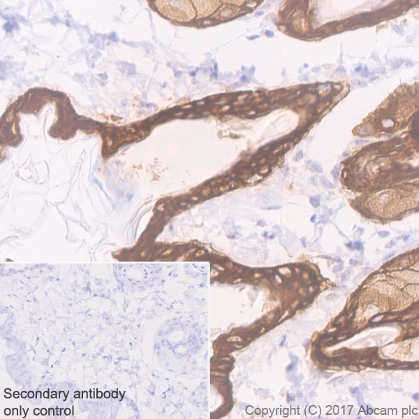 Immunohistochemistry of mouse skin tissue showing Cytokeratin 5 expression.