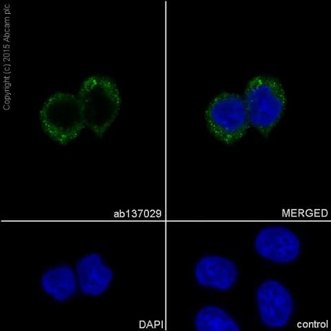 Anti-RAB7 antibody [EPR7589](AB137029)