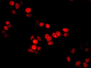C1d Antibody Epr11122 Ab166897  Immunocytochemistry Immunofluorescence Img100838