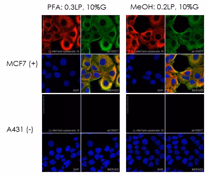 Confocal microscopy images comparing cytokeratin 19 expression in MCF7 cells (positive, top) and A431 cells (negative, bottom). Cytokeratin 19 shown in red (Alexa Fluor 647), nuclei in blue (DAPI).