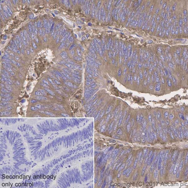 Anti-NF-kB p65 antibody [E379](AB32536)