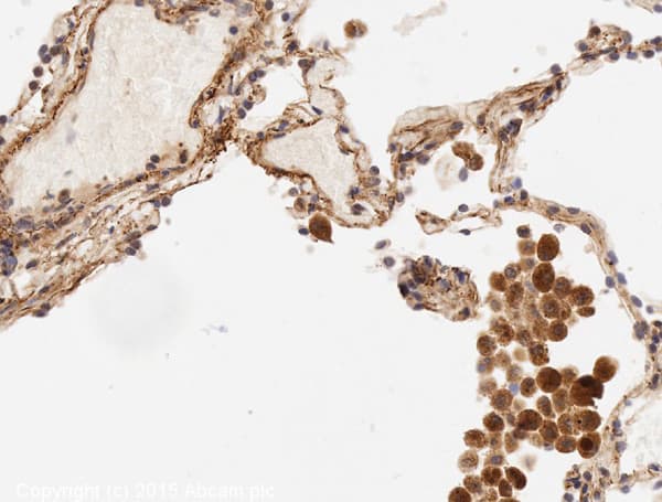 Anti-IL-6 antibody(AB6672)