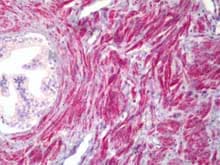 Anti-TMEPAI antibody(AB128006)