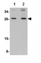 Scamp4 Antibody Ab113651  Western Blot Img17756