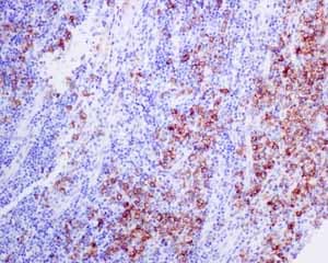 Anti-Syndecan-1 antibody [EPR6454](AB128936)