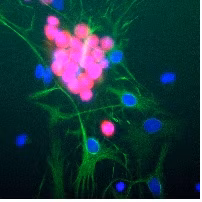Rat brain neural cultures stained with ab104224 (pink), ab4674 (green), and DNA (blue).