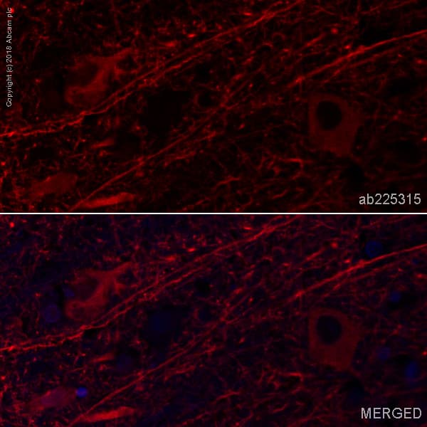 Alexa Fluor® 647 Anti-MAP2 antibody [EPR19691](AB225315)
