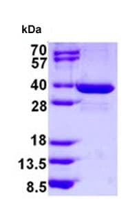 Recombinant Human spindlin 1 protein(AB128446)