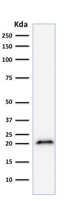 Anti-p21 antibody [CIP1/823](AB220206)