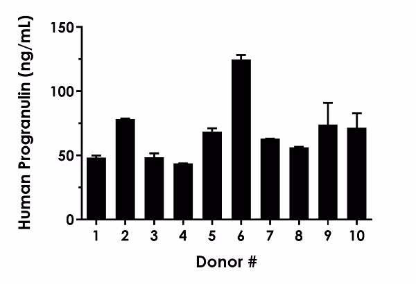 Scatter plot showing progranulin concentrations in serum from ten healthy female donors, with a mean of 67.7 ng/mL and a range of 43.7-124.8 ng/mL. Individual points shown with error bars (mean ± SD).