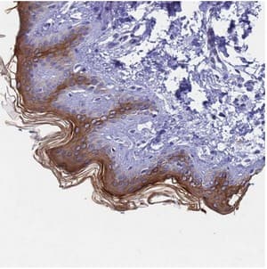 Keratin 77 Antibody Ab126329  Immunohistochemistry Formalin Pfa Fixed Paraffin Embedded Sections Img72655