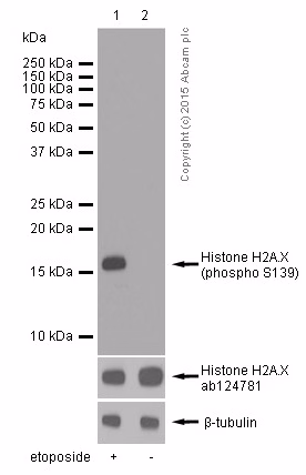 Western blot analysis of gamma H2A.X phosphorylation in HepG2 cells treated with etoposide.