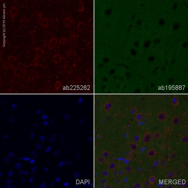 Alexa Fluor® 647 Anti-Choline Acetyltransferase antibody [EPR16590](AB225262)