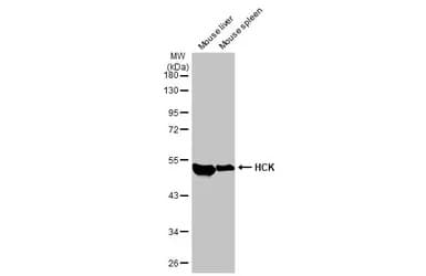 Hck Antibody Hl1673 Ab308234  Western Blot Img407220