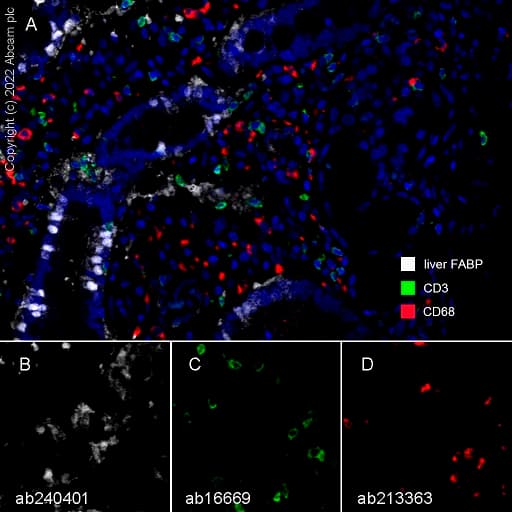 Anti-CD68 antibody [EPR20545](AB213363)