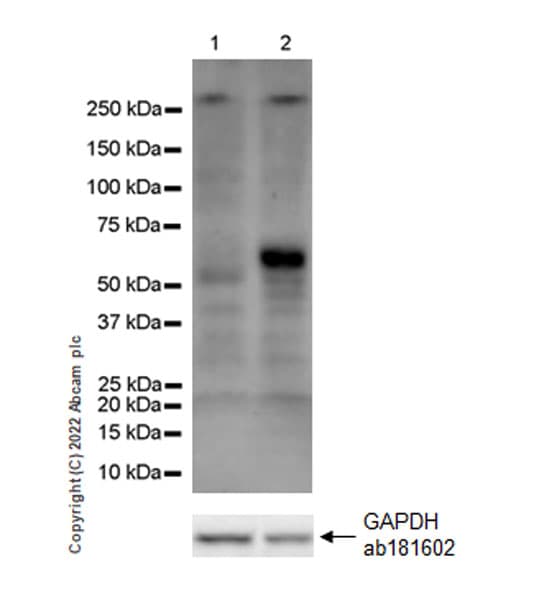 Anti-MAdCAM1 antibody [EPR27223-77](AB307827)
