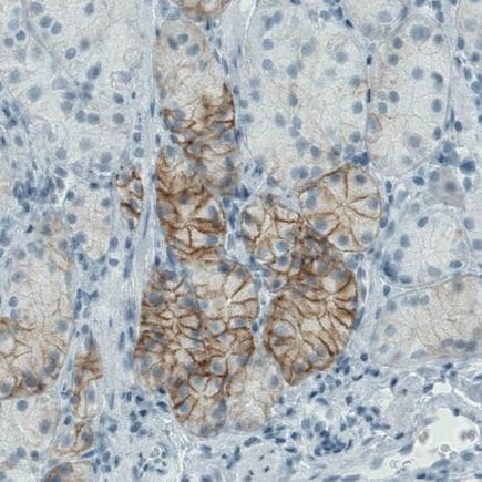Carbonic Anhydrase 12 Ca12 Antibody Cl0278 Ab242316  Immunohistochemistry Formalin Pfa Fixed Paraffin Embedded Sections Img131626