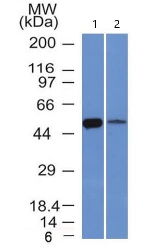 Anti-ALDH1A1 antibody [ALDH1A1/1381] - BSA and Azide free(AB269761)