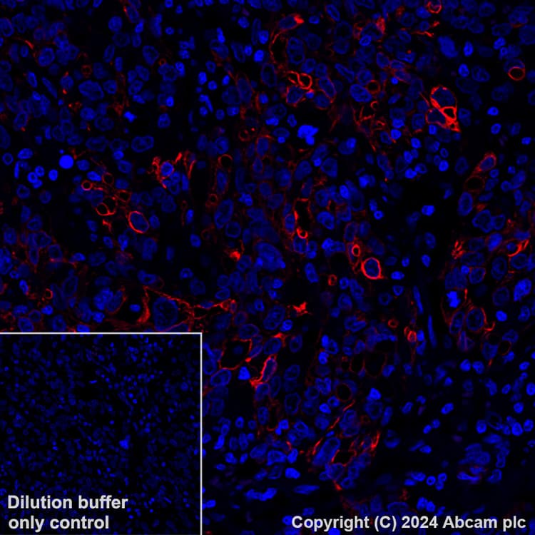 Alexa Fluor 647 Cytokeratin 5 Antibody Ep1601y Ab193895  Immunohistochemistry Formalin Pfa Fixed Paraffin Embedded Sections Img448921