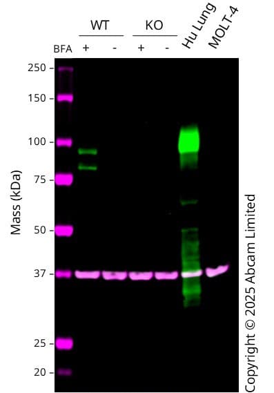Anti-MMP9 antibody [RM1020](AB283575)