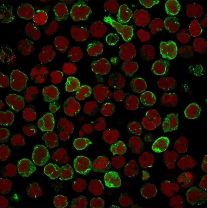 Cd134 Ox40l Receptor Antibody Ox40 3108 Ab270727  Immunocytochemistry Immunofluorescence Img108974
