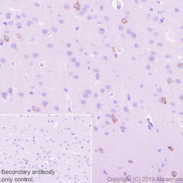 Anti-Reelin antibody [EPR22515-75](AB230820)