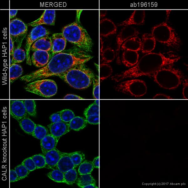 Alexa Fluor® 647 Anti-Calreticulin antibody [EPR3924] - ER Marker(AB196159)