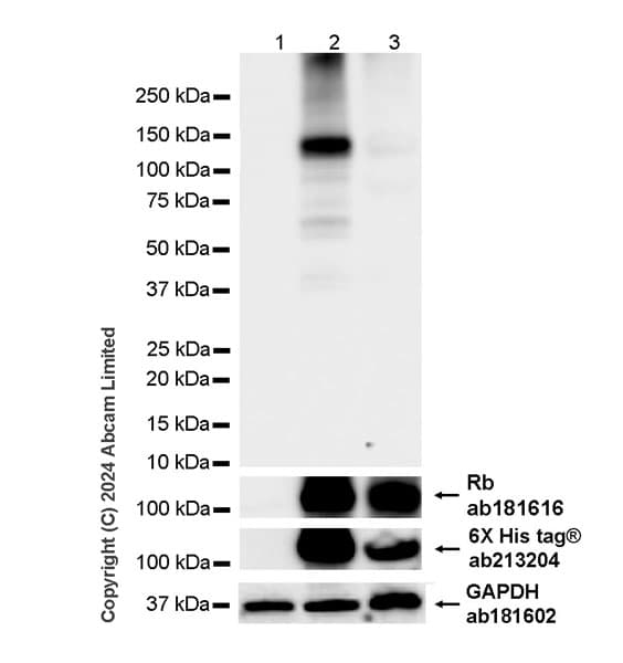 Anti-Rb antibody [EPR17512](AB181616)