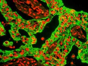 Anti-Cytokeratin 8 antibody [EP1628Y] - Cytoskeleton Marker(AB53280)