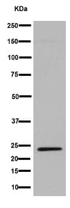 Lhfpl5 Antibody Epr16285 C Terminal Ab192242  Western Blot Img45222