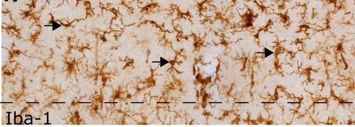 Immunohistochemical staining of microglia in human prefrontal cortex, labeled with iba1 antibody.